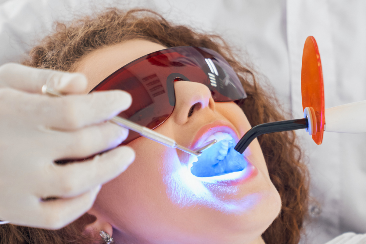 How Does Laser Whitening Work? Iron City Dentistry